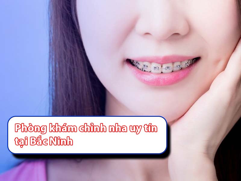 Nếu bạn cần tìm phòng khám chỉnh nha tại Bắc Ninh an toàn và tốt nhất thì hãy đọc ngay bài viết sau đây của Tdentist nhé.