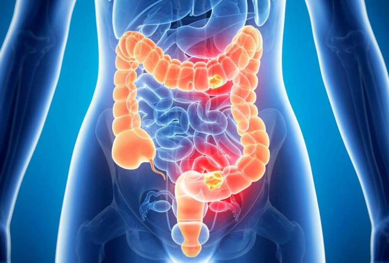 Thải độc đại tràng Detoxify - “Công thần” thải độc cơ thể, giúp nâng cao sức khỏe toàn diện 